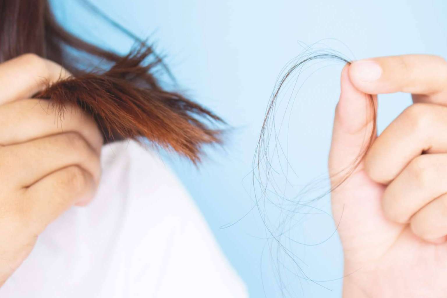 ¿Cómo saber si se tiene alopecia?