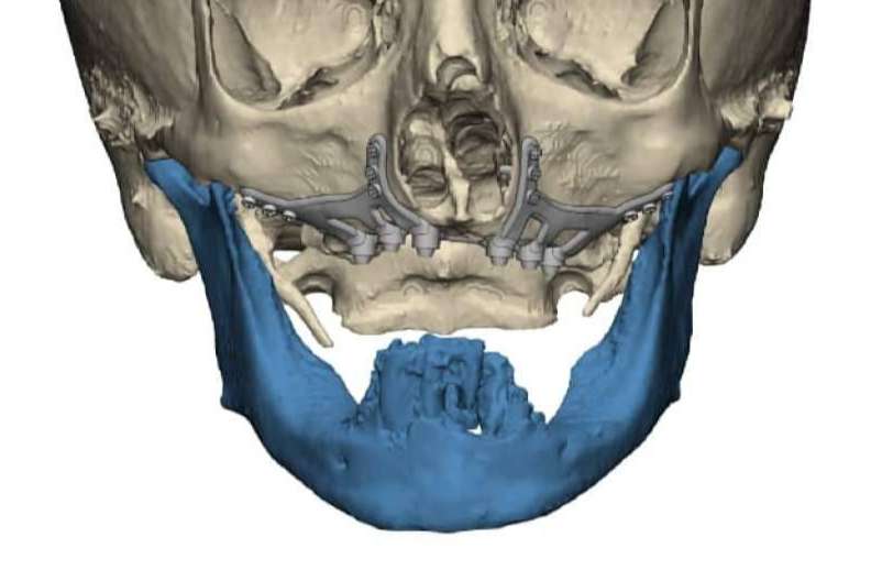 La Clínica Calvo de Mora es una clínica maxilofacial especializada en cirugías ortognáticas