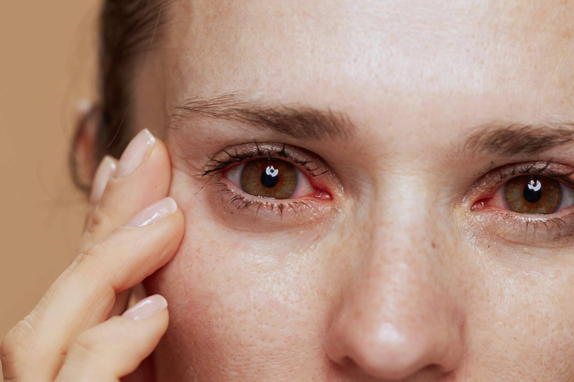 Tratamientos avanzados para el ojo seco en el Hospital Universitario Dexeus Barcelona