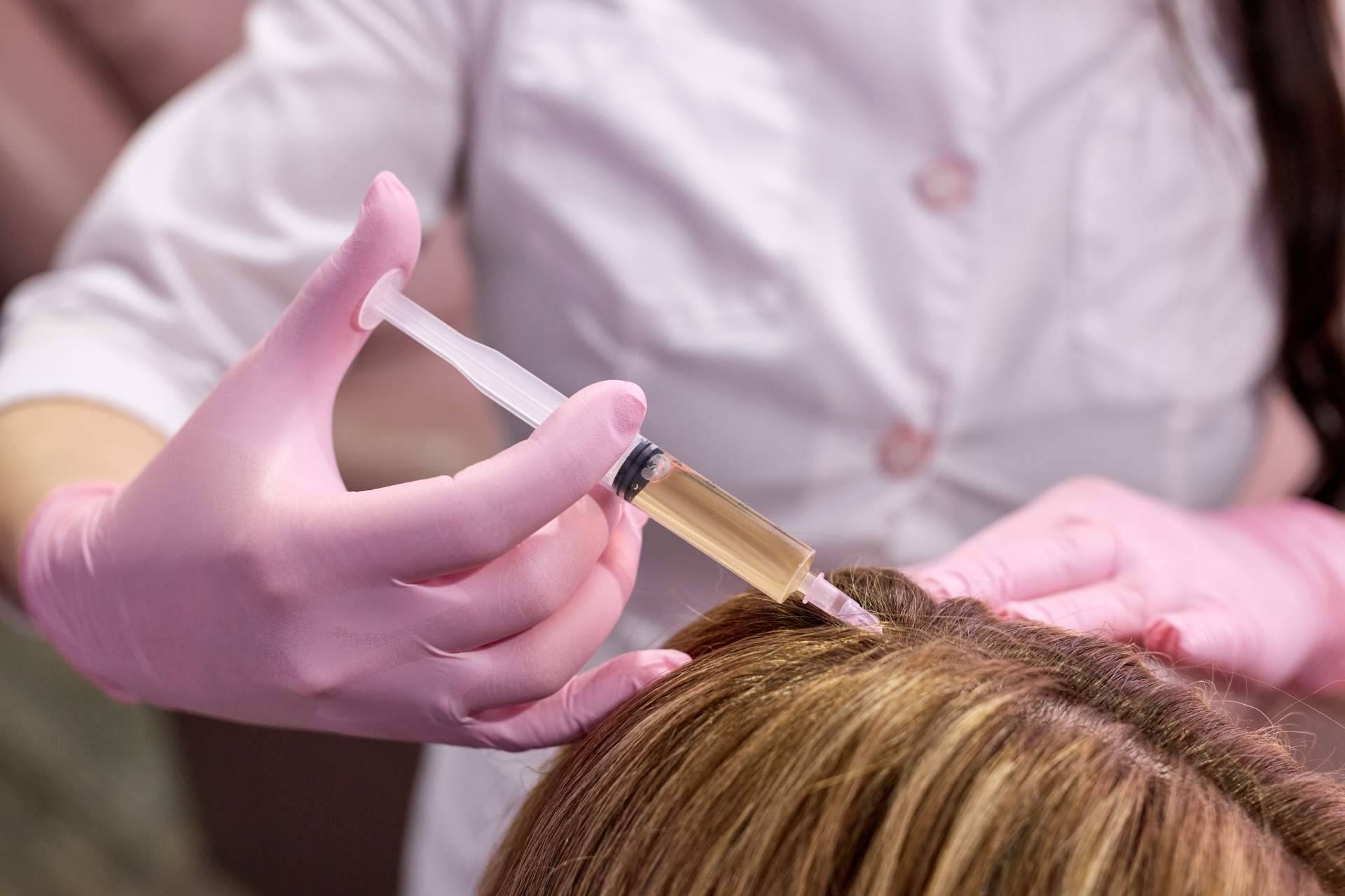 El tratamiento del Doctor Jesús Aníbal Mora previene la alopecia femenina