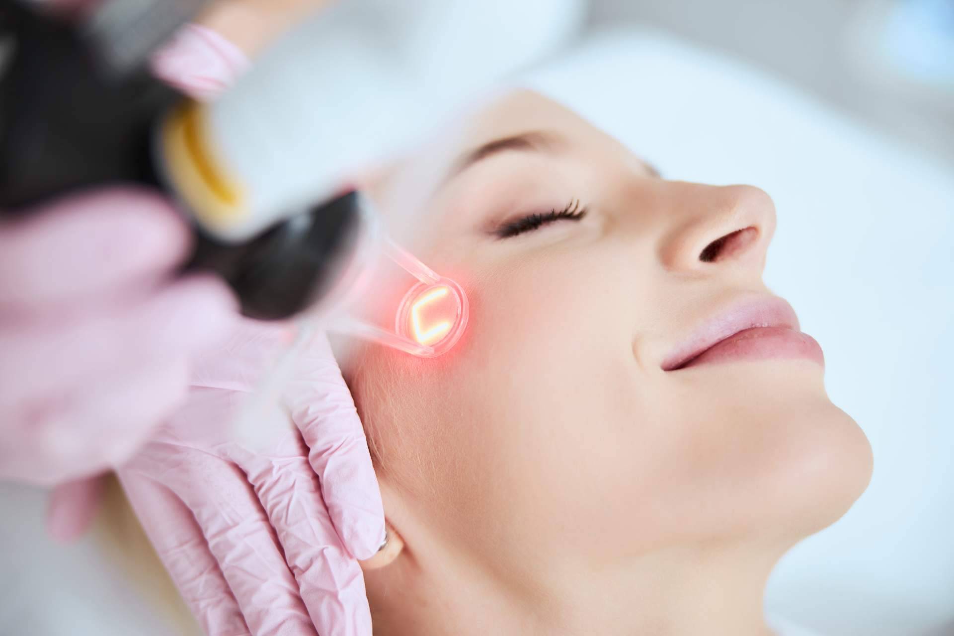 Centro Estética El Pilar ofrece tratamiento para eliminar marcas del acné con láser