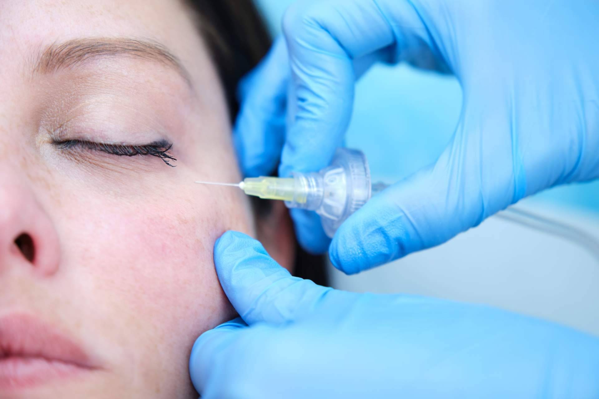 Corrección de las ojeras en Centro Estética El Pilar