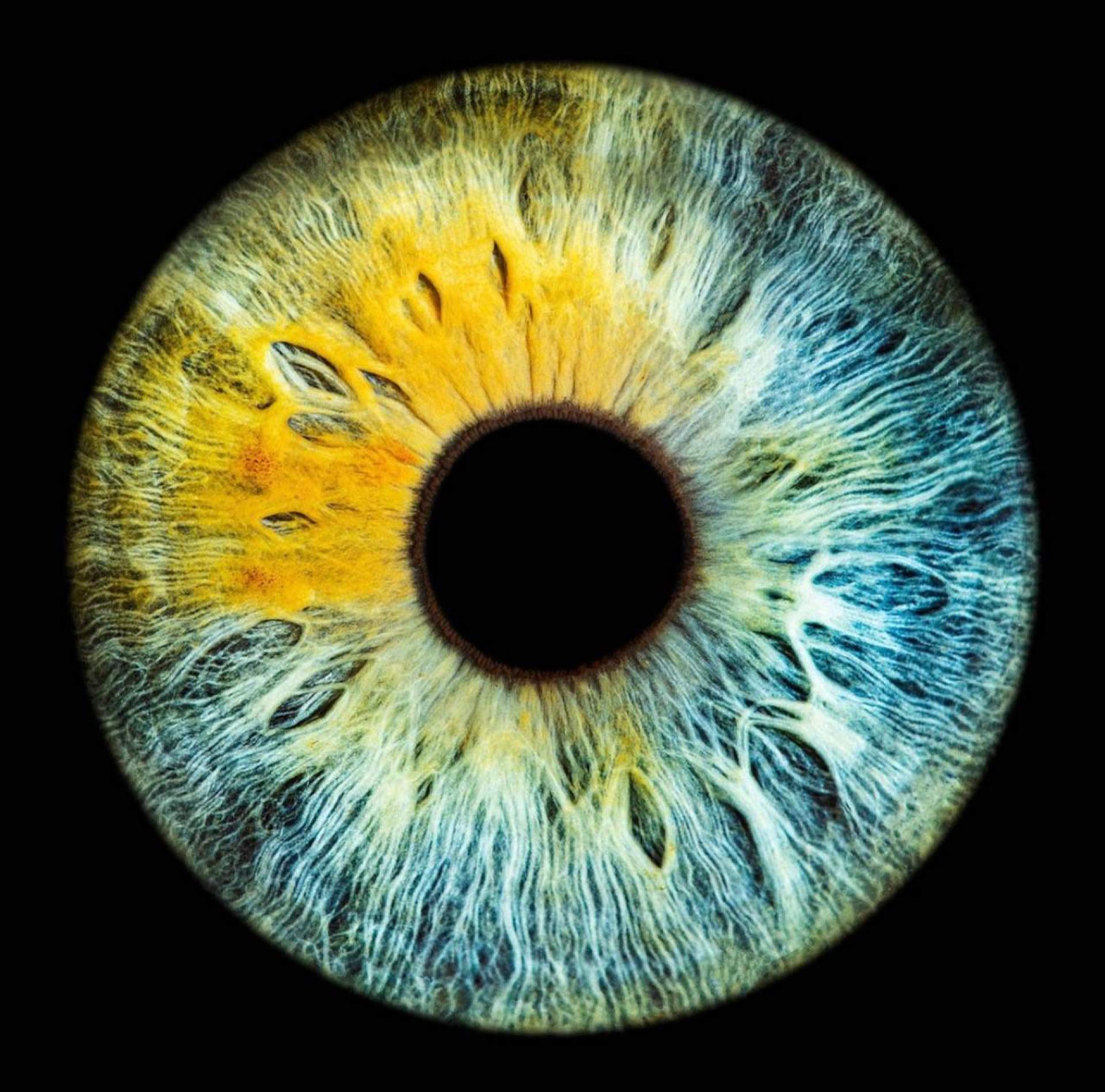 Los ojos también tienen pecas o nevus