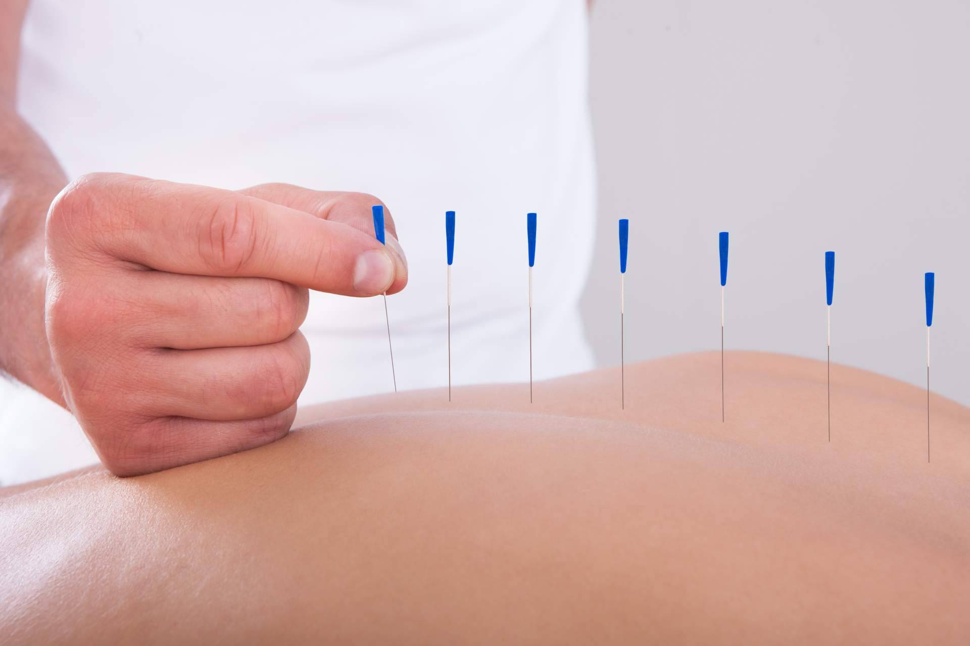 Vital Balance se consolida como un centro especializado en acupuntura en Málaga