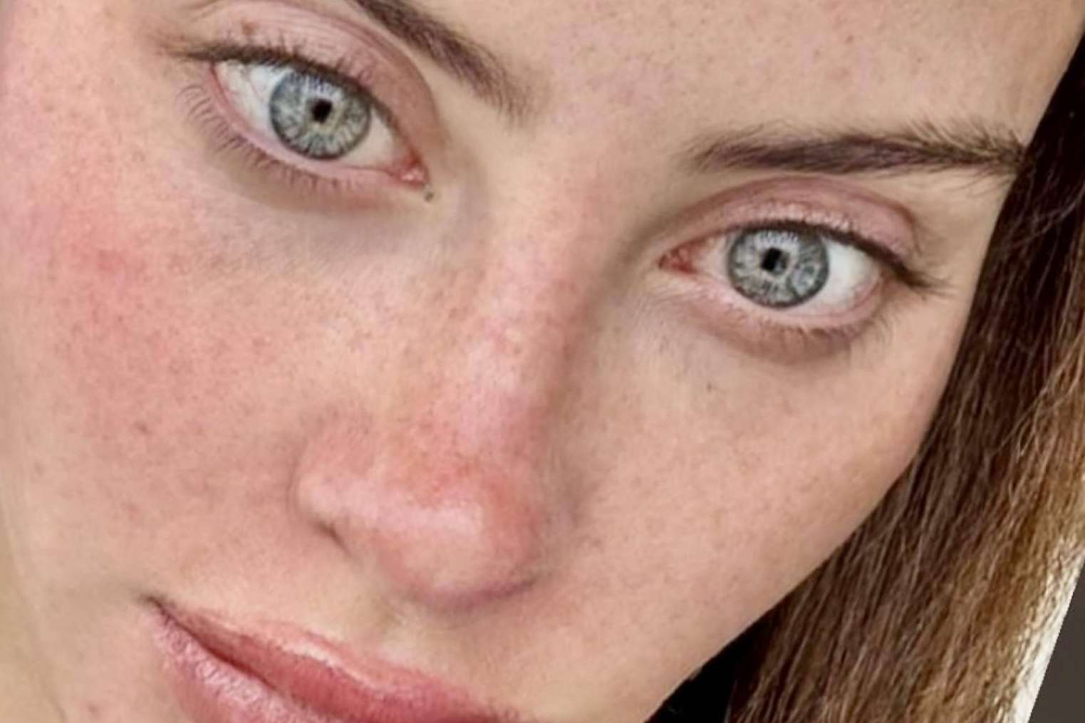 Tratamientos de estética facial en Eyecos, tecnología avanzada para el cuidado de la piel