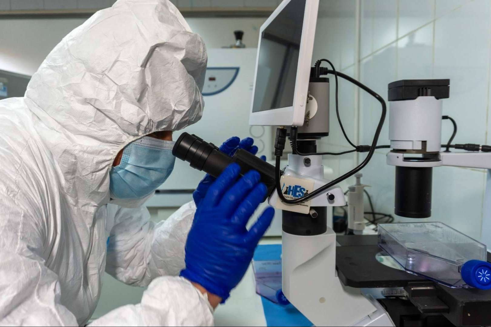 Oncovix, el programa de inmunoterapia avanzada que revoluciona el tratamiento del cáncer