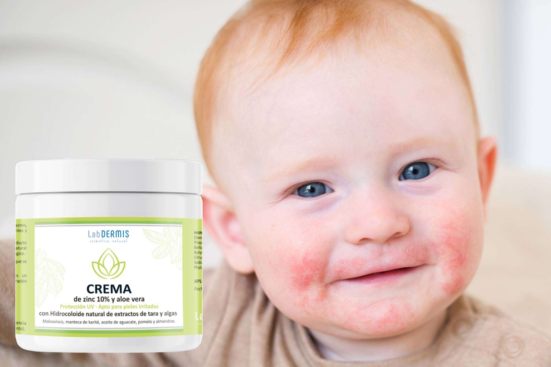 El laboratorio LabDERMIS propone formulas únicas para tratar pieles sensibles y con dermatitis atópica