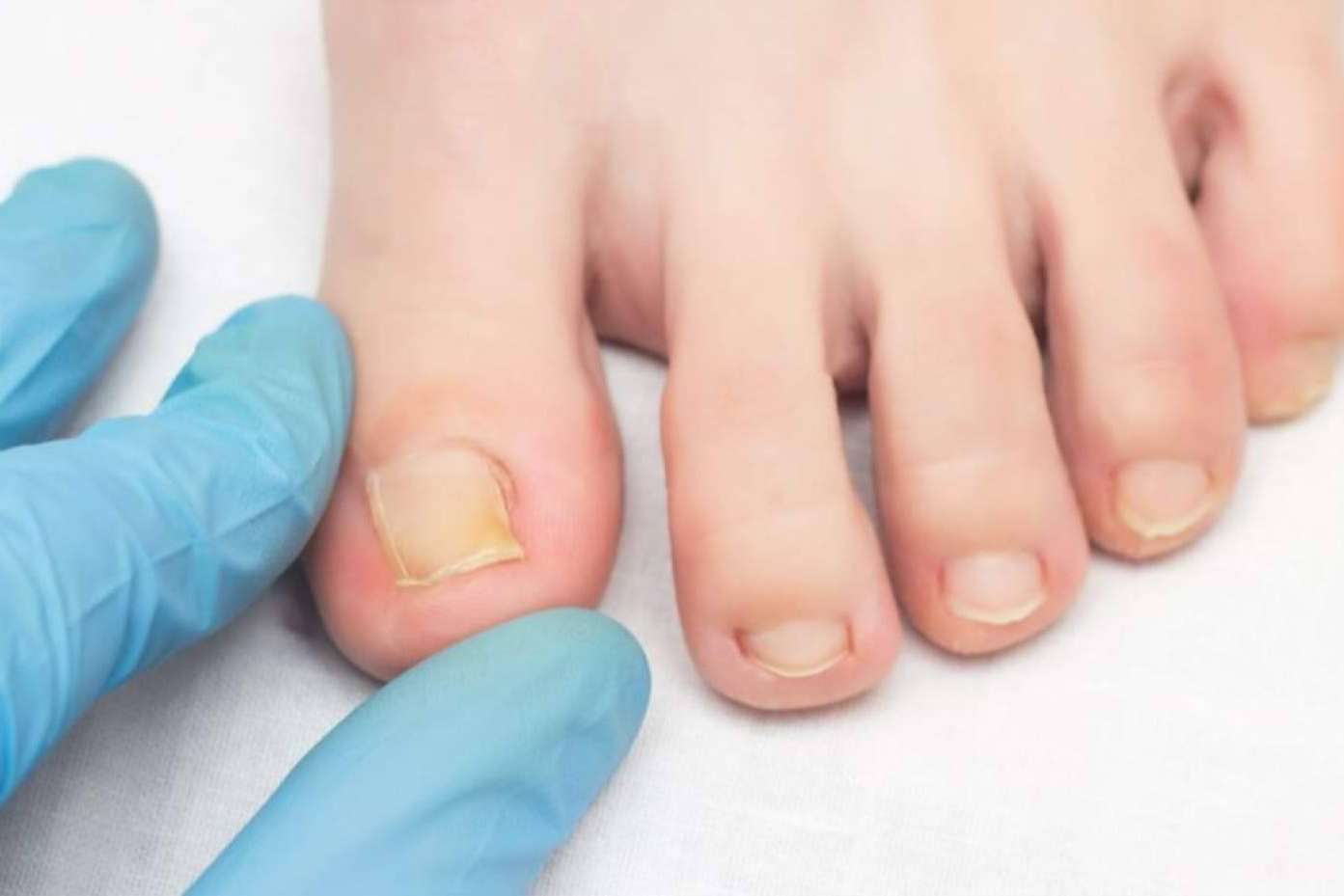 Mycogel, el gel limpiador que refuerza la higiene frente a hongos y micosis