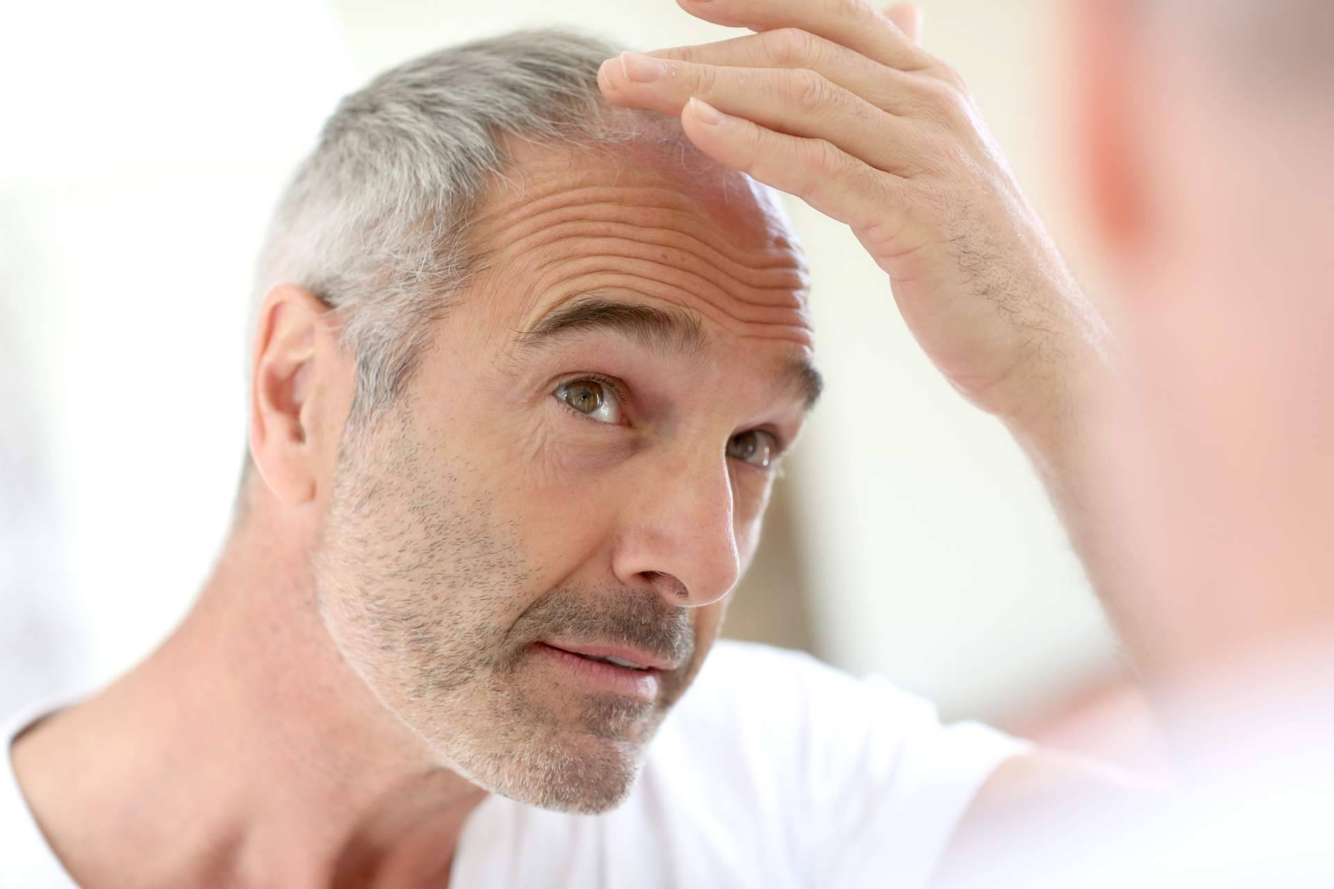 CareDerm desarrolla nutracéuticos innovadores para el cuidado del cabello y las uñas