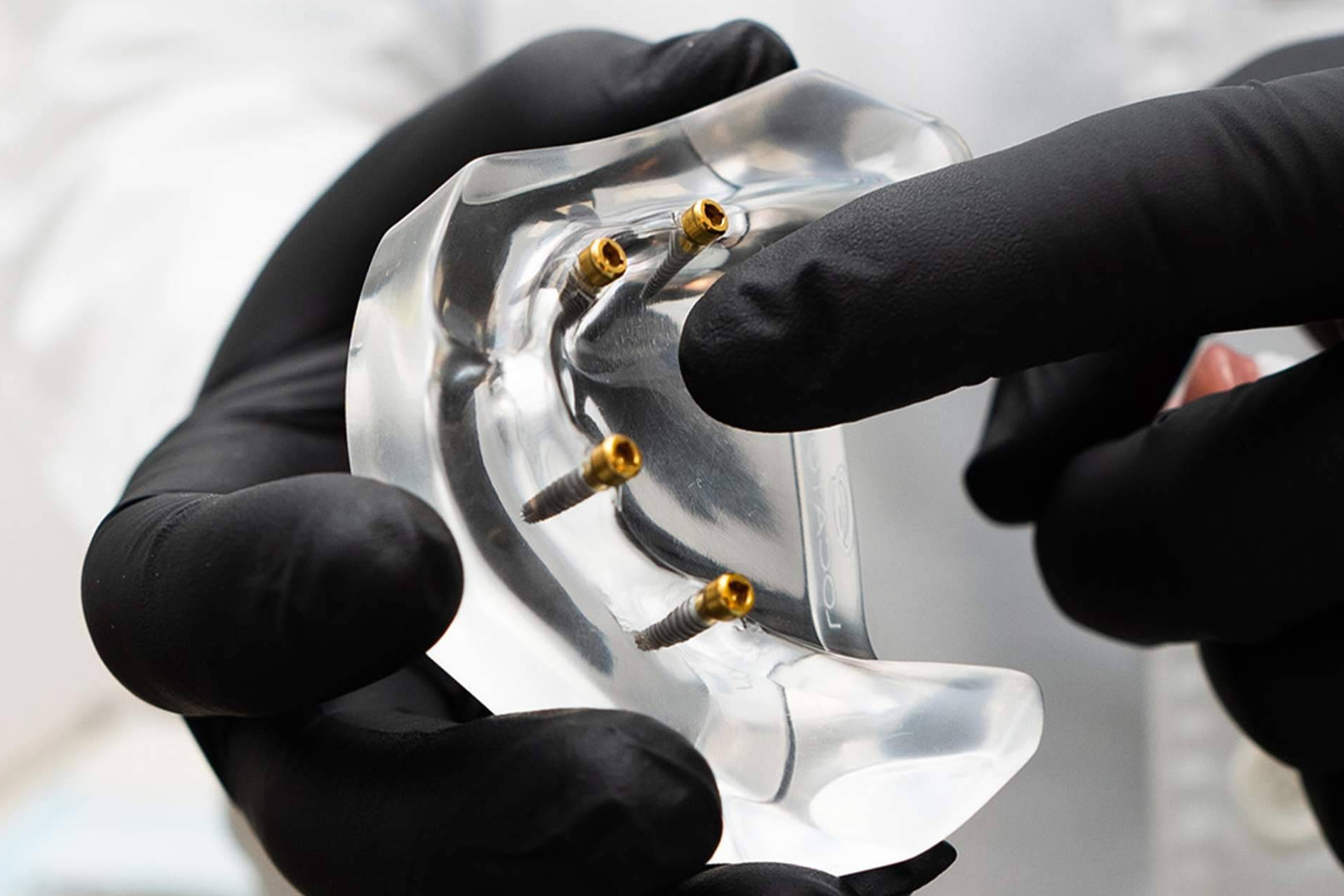 Clínica Calvo de Mora ofrece implantes dentales avanzados con enfoque multidisciplinar en Madrid