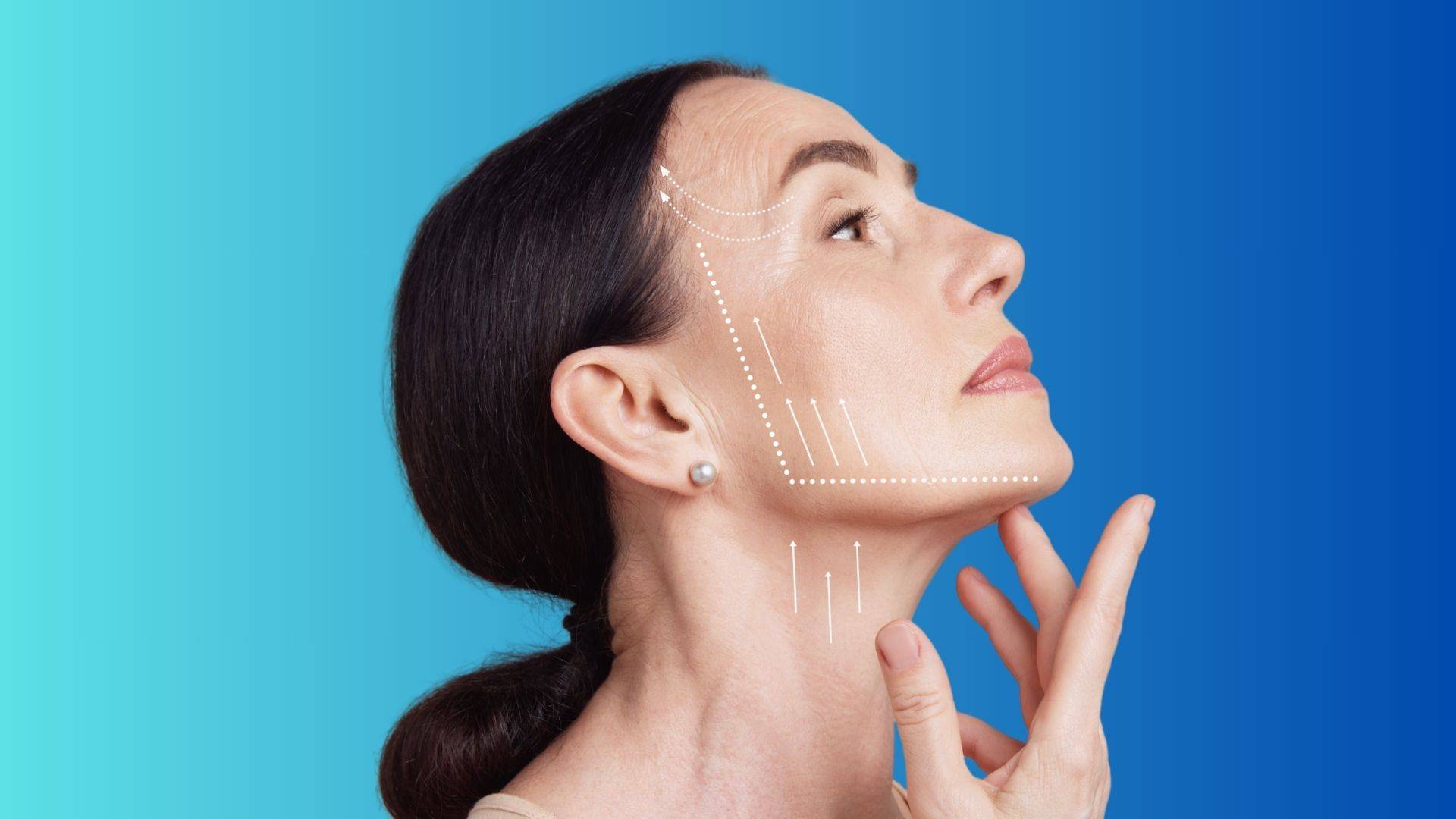 Scalpel integra Morpheus8 y Endolift® para tratar la flacidez cutánea en diferentes capas de la piel